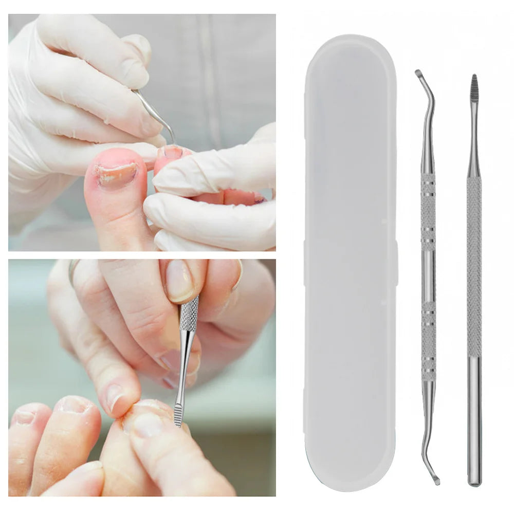 2PCS/set Stainless Toe Nail File Double Ended Pedicure File Edge Ingrown Toe Nail Lifter Paronychia Podiatry Nail Care Tools