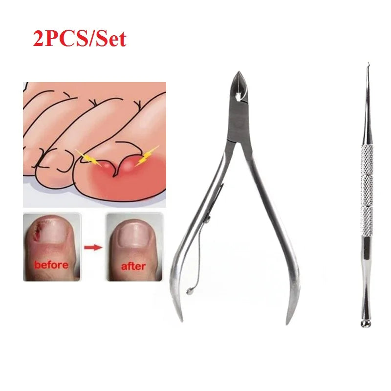 2PCS/Set Ingrown Foot Care Tool Toe Nail Correction Nippers Clipper Cutters Dead Skin Dirt Remover Paronychia Podiatry Pedicure